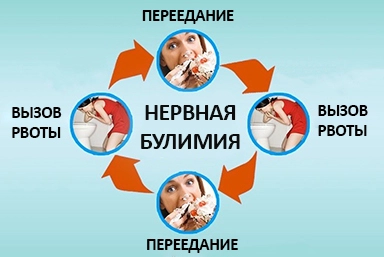 Лечение булимии в Иглино
